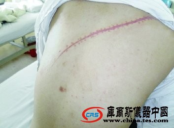 女大學(xué)生因感情不和提分手遭男友割喉(圖)